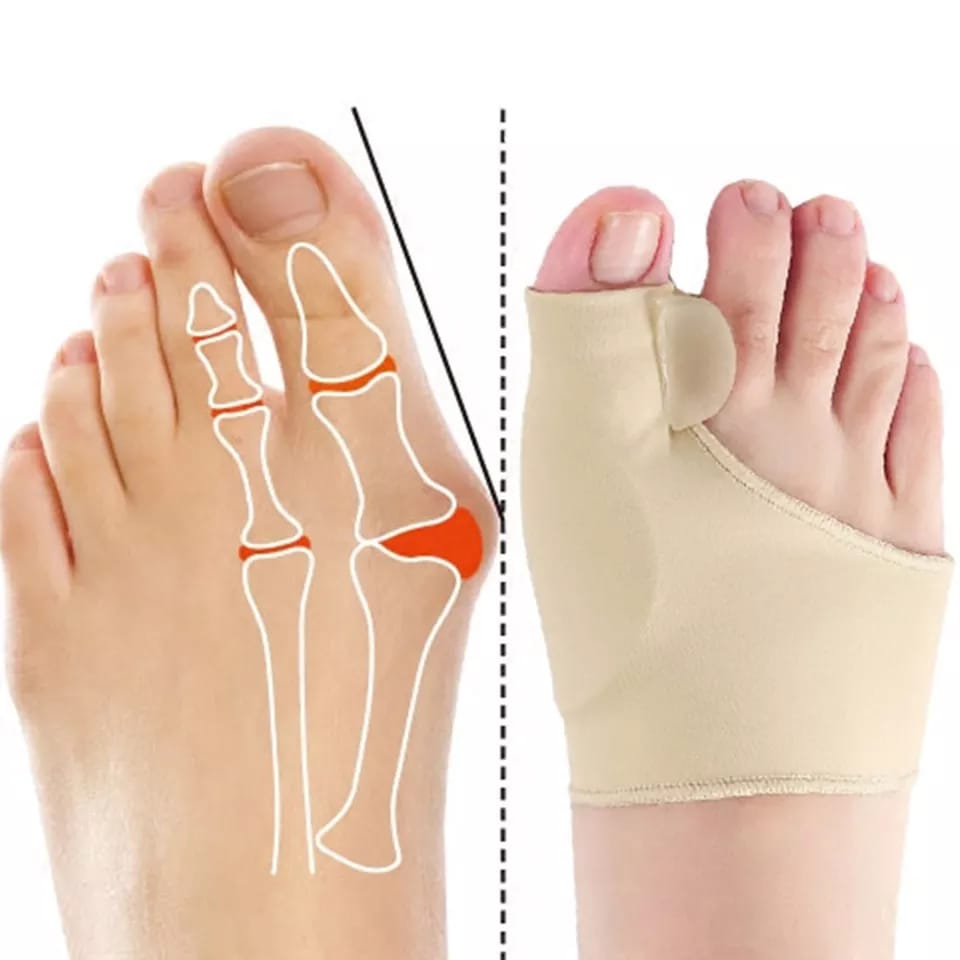 CORRECTOR ORTOPEDICO PARA PIES (1 PAR) - (adaptable)