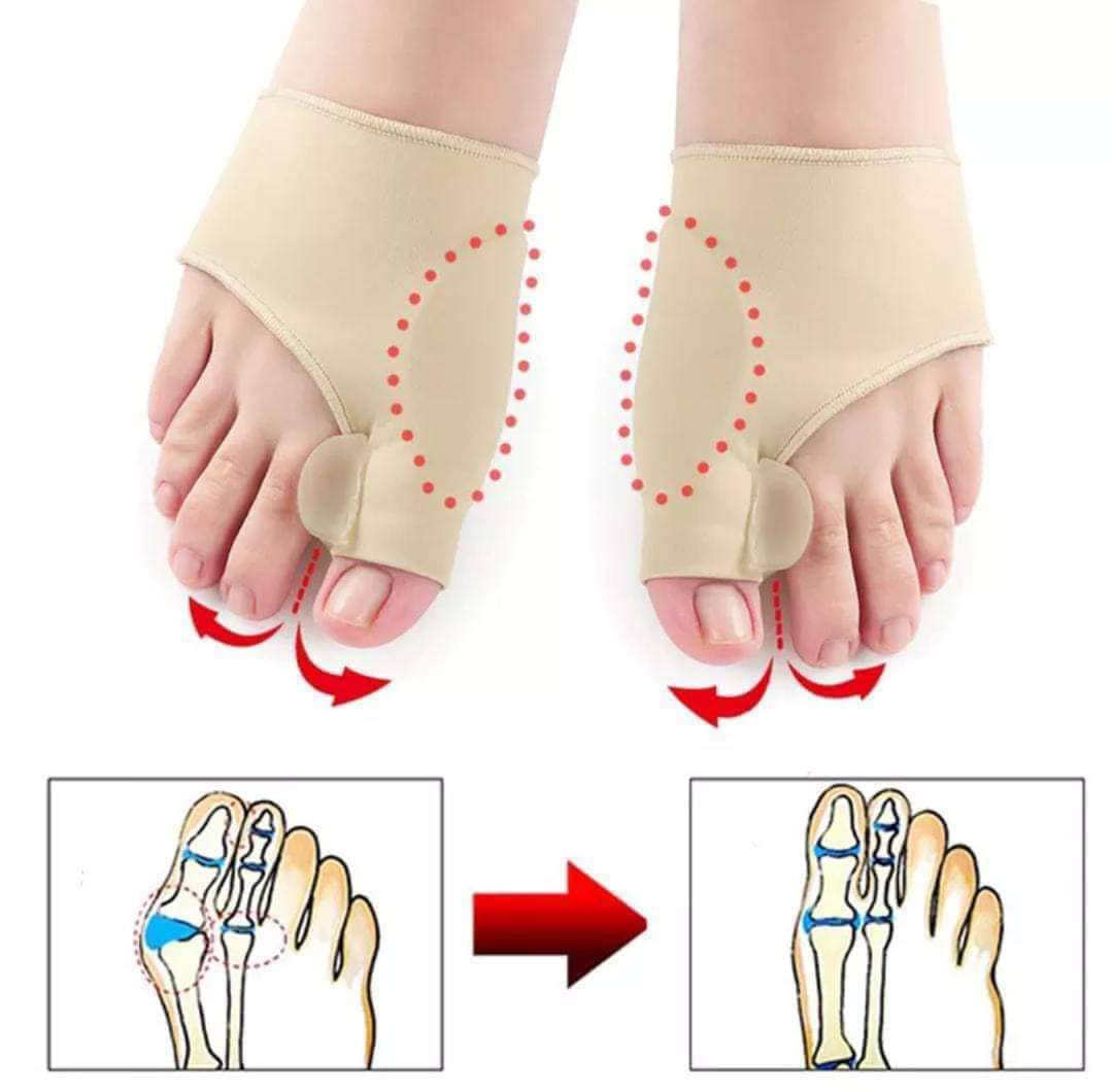CORRECTOR ORTOPEDICO PARA PIES (1 PAR) - (adaptable)
